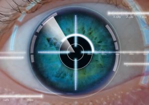 Augen Lasern Risiken - Hoch oder zu vernachlässigen?