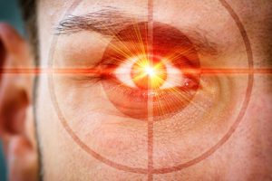 Hornhautverkrümmung lasern lassen